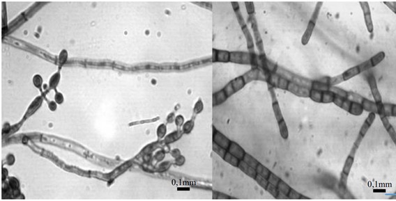 Aspectos Morfológicos Das Células E Hifas Do Fungo Entomopatogênico Metarhizium Anisopliae