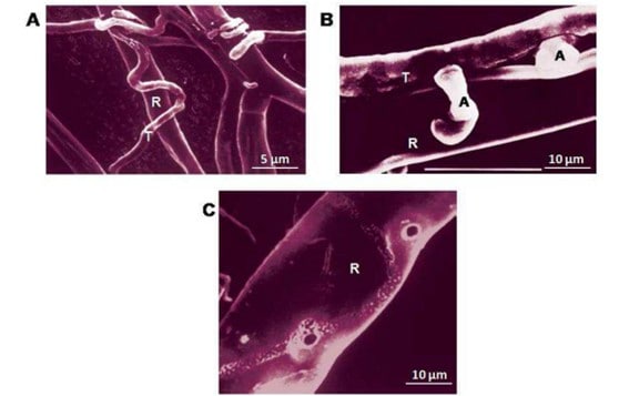 Micoparasitismo De Trichoderma Spp (T). Em Rhizoctonia Solani (R), Evidenciado Pela Presença Dos Buracos Na Parede Celular Das Hifas De R.solani Após A Retirada De Trichoderma Spp (C). 